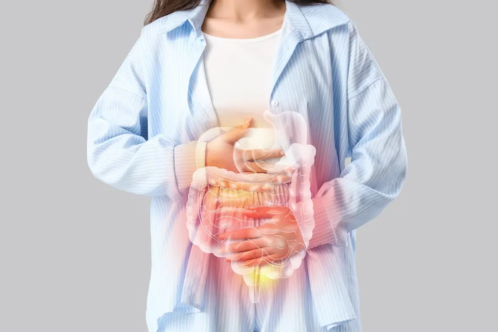 Colitis ulcerosa y Crohn — tratamiento en Zapopan, Dr. Erick Rojas